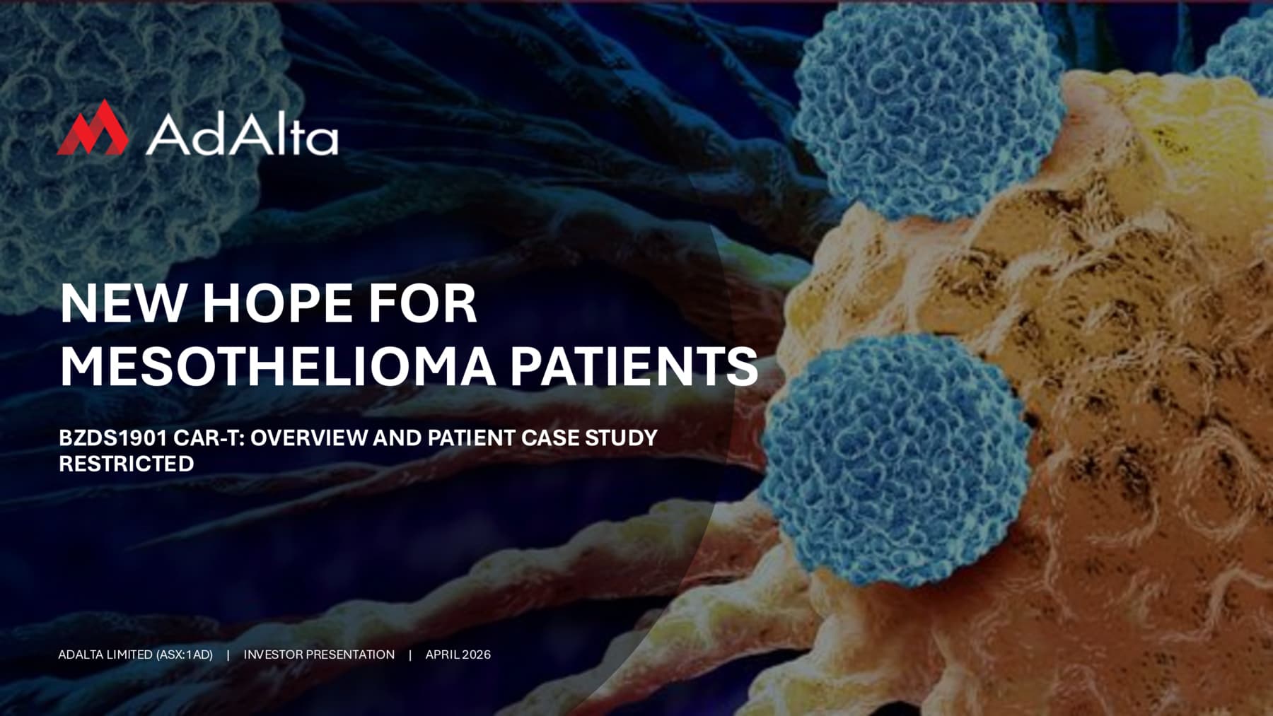 Webinar presentation - new hope for mesothelioma patients